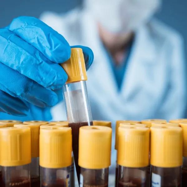 Blood analysis laboratory