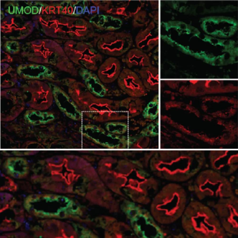 Uromodulin image